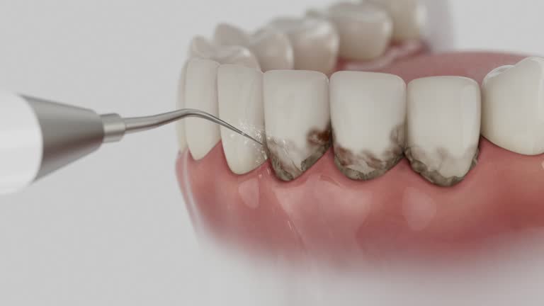 Trusted Teeth Cleaning And Checkup service in Vinco, PA - Dentist Open Now